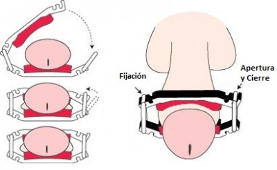 Colocacion Dribblestop_esp